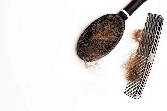 Meilleurs Produits De Croissance Des Cheveux Pour Hommes. Traitements Contre La Perte De Cheveux Qui Fonctionnent